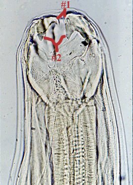 Anchilostoma Braziliensis