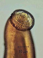 Gnathostoma spinigerum